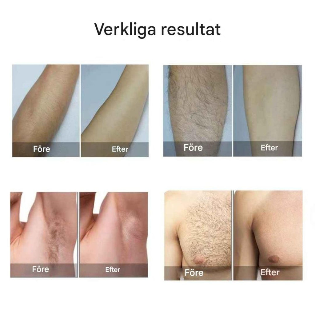 SilkPro X1 IPL Hårborttagning för Permanent Slät Hud