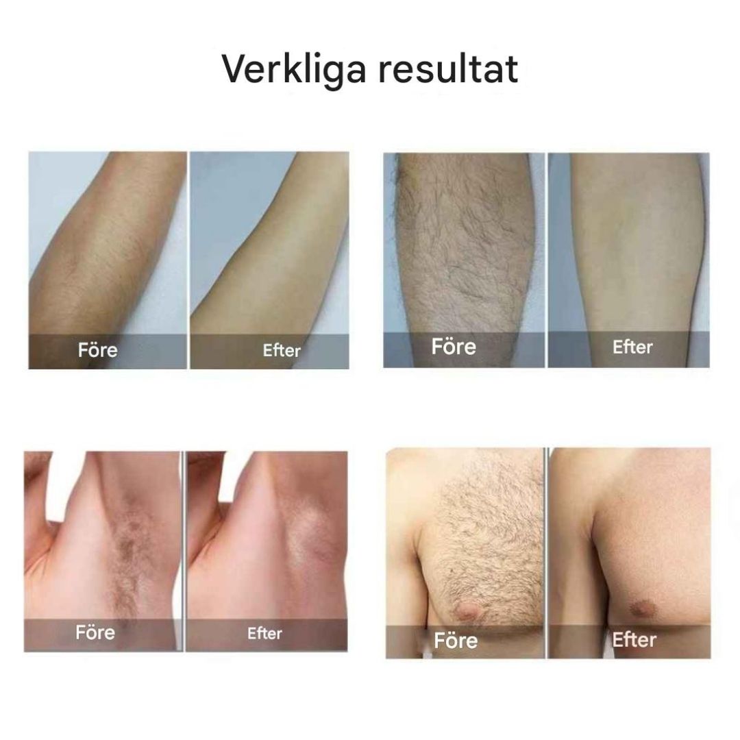 SilkPro X1 IPL Hårborttagning för Permanent Slät Hud